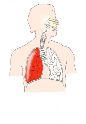 Pi respiranch onemocnnch zapomete na vdechovn hork pry